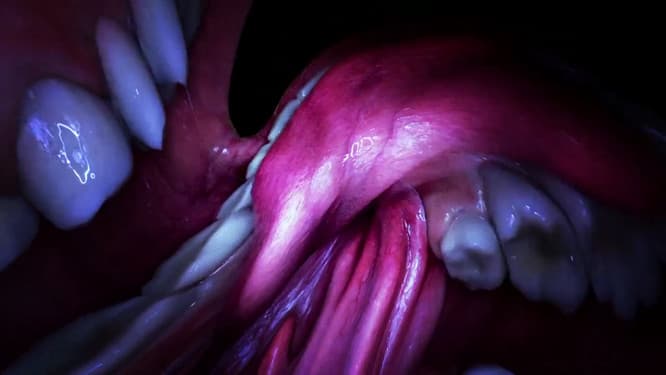Jesse Kanda監督の「Mouth Mantra」。歌っているビョークの口の中。　©Jesse Kanda